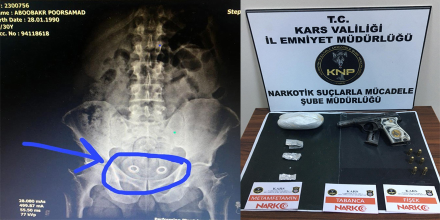 İran uyruklu bir kişinin mide ve bağırsağından uyuşturucu çıktı