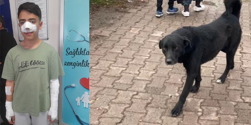 Kars'ta 13 yaşındaki çocuğa sokak köpekleri saldırdı