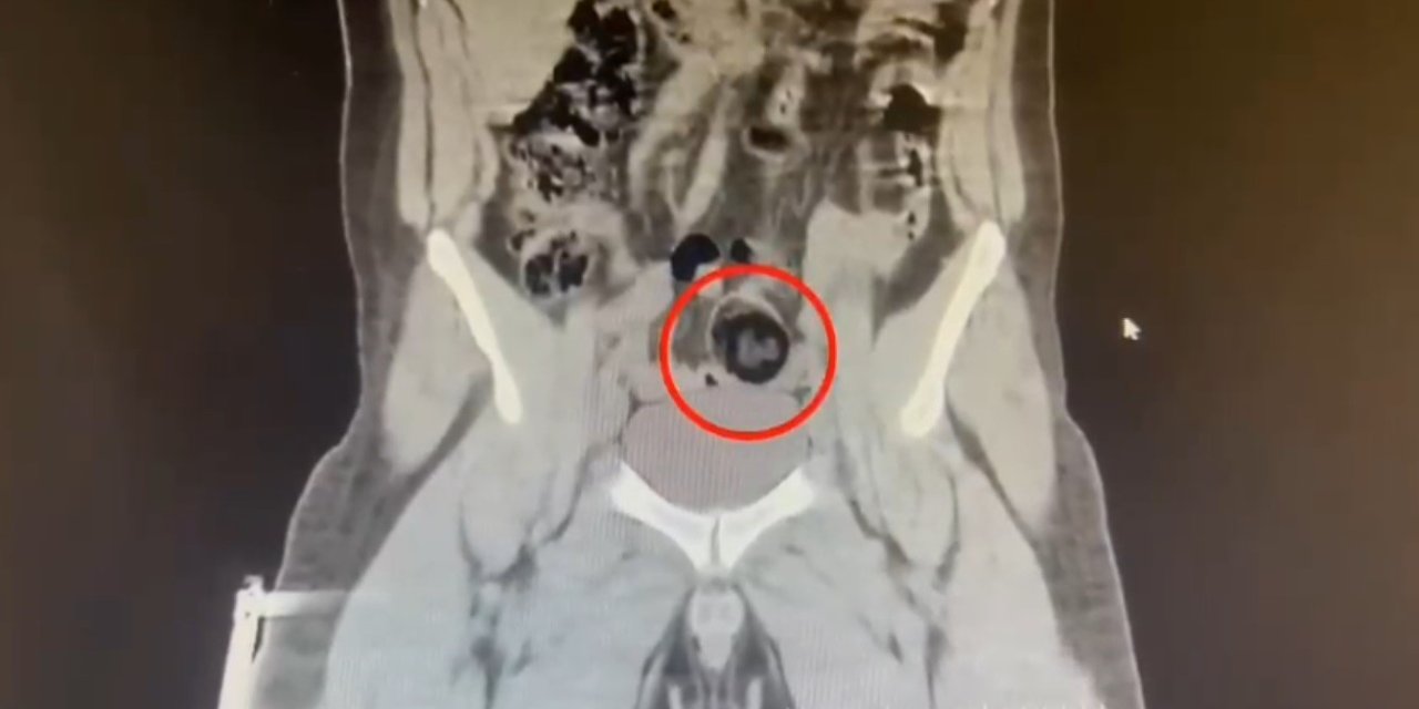 Kars’ta İranlı kuryenin makatından uyuşturucu çıktı