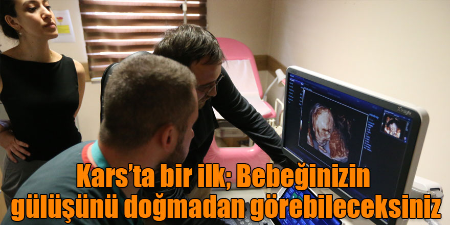 Kars’ta bir ilk; Bebeğinizin gülüşünü doğmadan görebileceksiniz