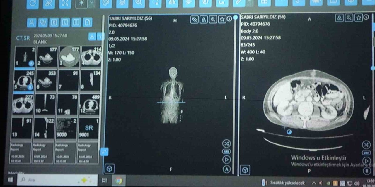 Van’dan dünyaya örnek çalışma: Kanser tedavisinde yapay zekâ kullanıldı