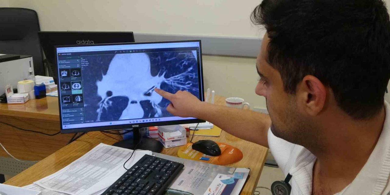 Kansersin, astımsın dediler: Akciğerinden kabak çekirdeği çıktı