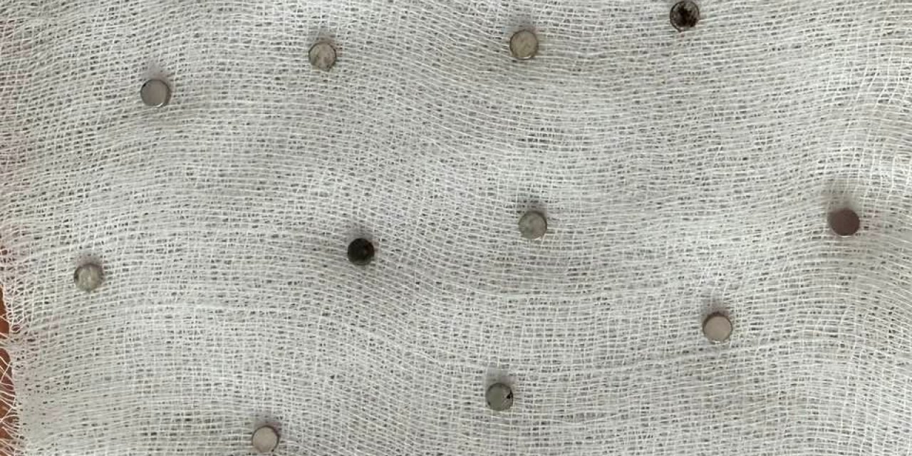 Çocuğun boğazından 19 adet mıknatıs çıkartıldı