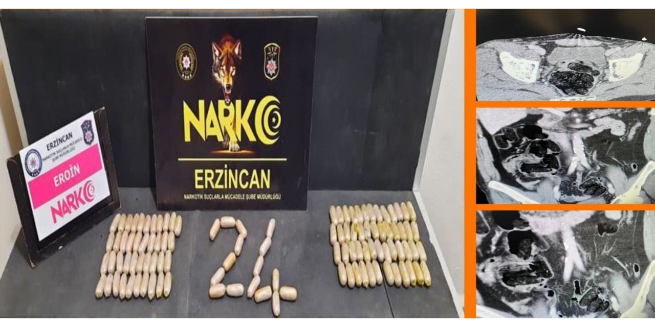Erzincan polisinden çarpıcı operasyon: Midelerinde 109 ölüm kapsülü