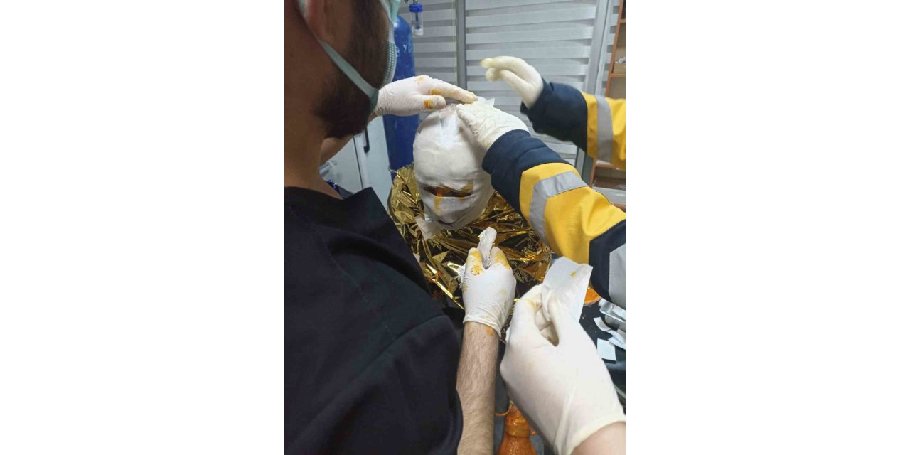 Erzincan’da kömür ocağında yangın: 2 işçi yaralı