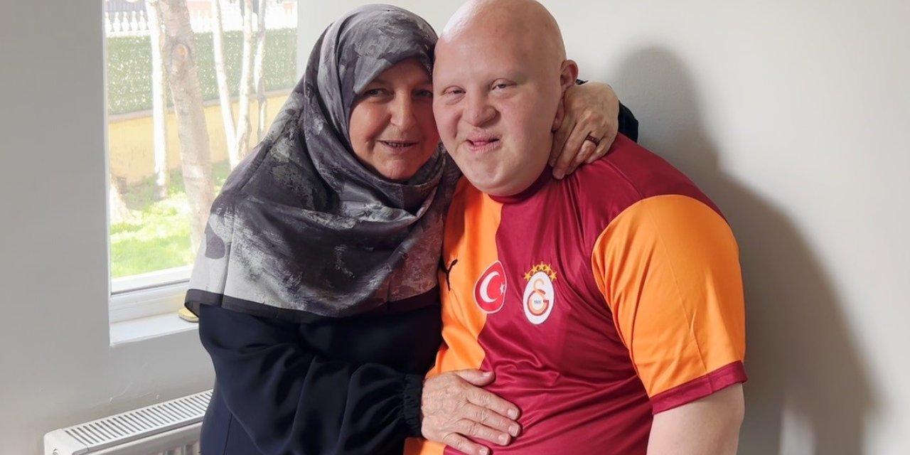 Down sendromlu annesinin sosyal alan ve anlayış isteği