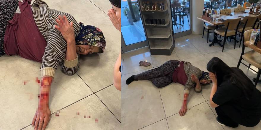 Tekmelere aldırmayan köpek kadının kolunu kopardı