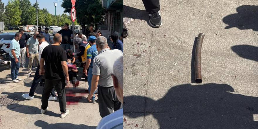 Yaralı babanın zor anları: "Oğlum sakın ölme"