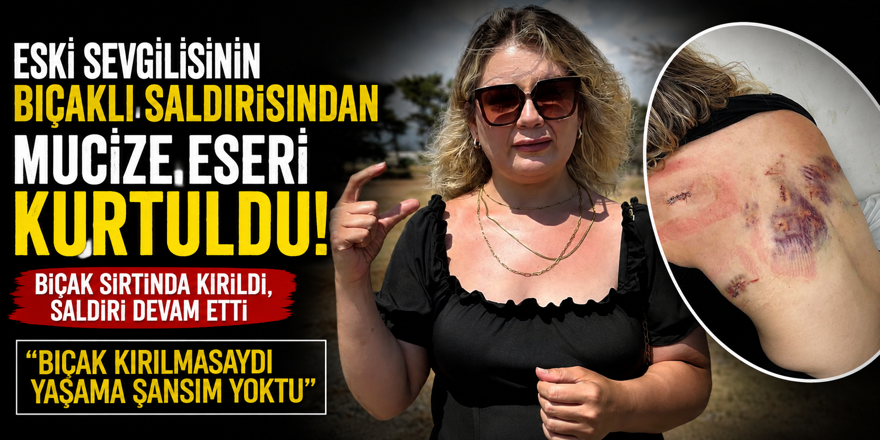 Eski Sevgilisinin Bıçaklı Saldırısından Mucize Eseri Kurtuldu