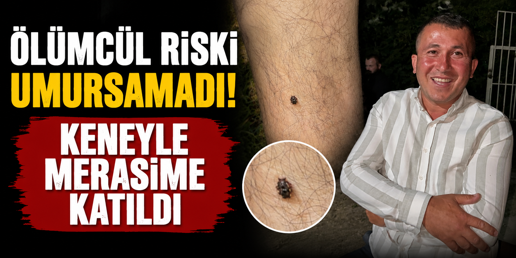 Ölümcül Riski Umursamadı! Keneyle Merasime Katıldı