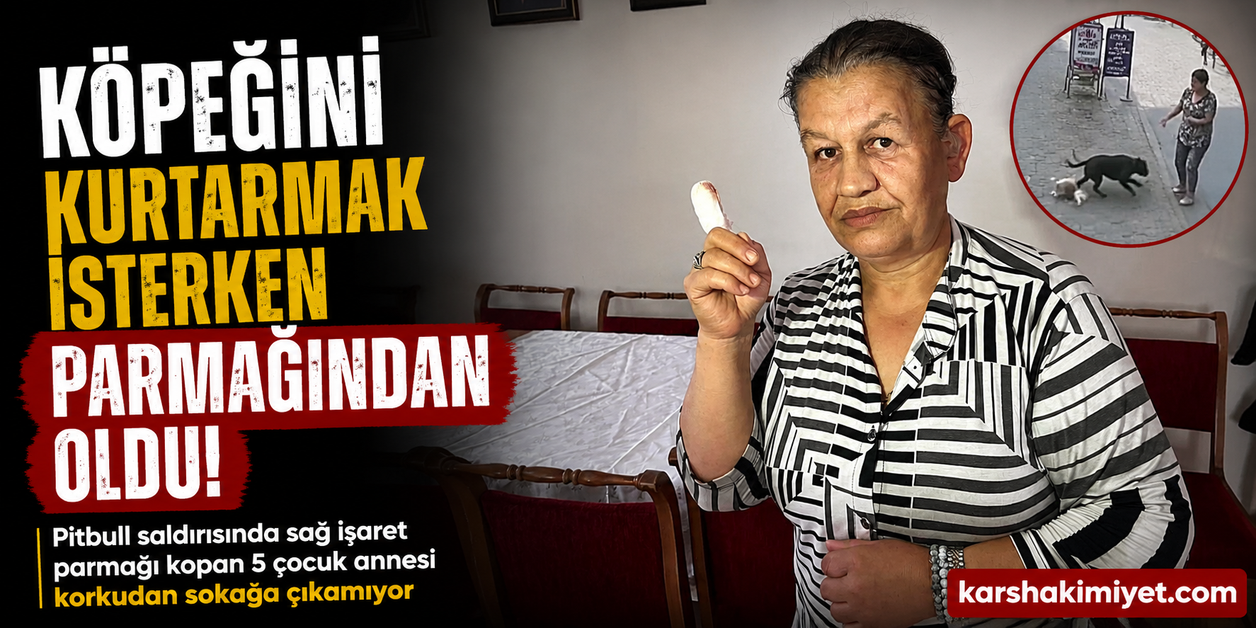 Köpeğini Kurtarmak İsterken Parmağından Oldu