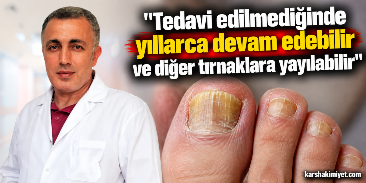 "Tedavi edilmediğinde yıllarca devam edebilir ve diğer tırnaklara yayılabilir"