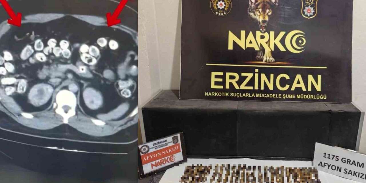Erzincan’da uyuşturucuyu vücutlarında taşıyan 3 şüpheli yakalandı
