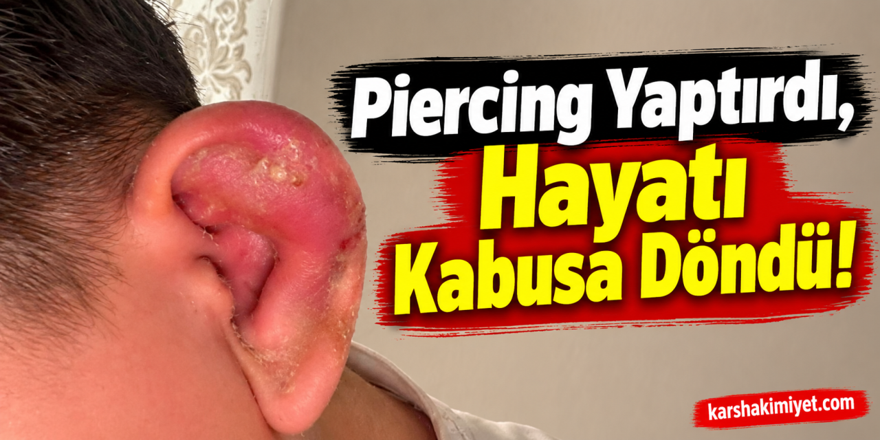 Piercing Yaptırdı, Hayatı Kabusa Döndü!