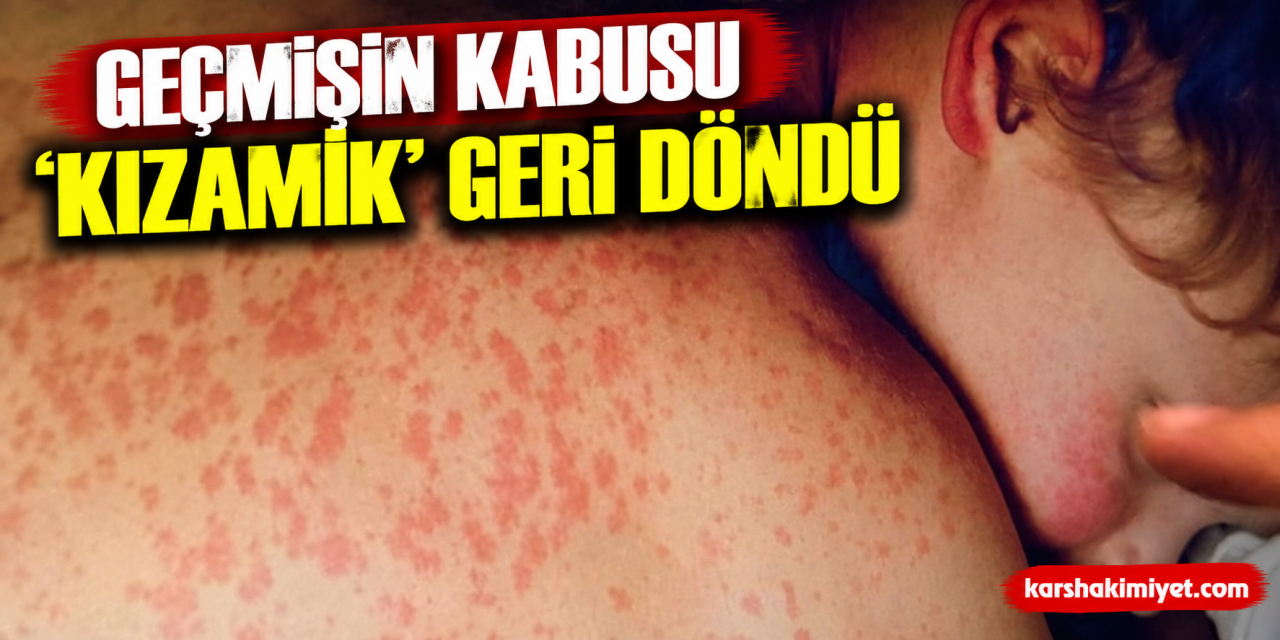 Geçmişin kabusu ‘kızamık' geri döndü