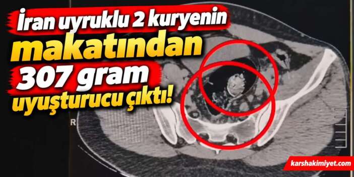 İran uyruklu 2 kuryenin makatından 307 gram uyuşturucu çıktı!