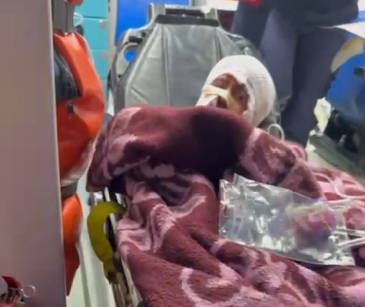 Çocuğu köpek saldırısına uğrayan babanın feryadı: "Bu işe bir çözüm bulun. Artık anne ve babalar gözyaşı dökmesin"